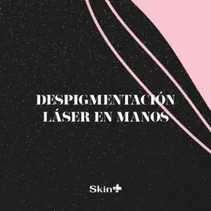 Despigmentación Láser en Manos